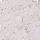 Immunohistochemical staining of human skeletal muscle shows no positivity in myocytes as expected.