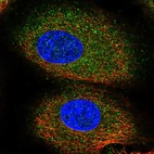 Immunofluorescent staining of human cell line A549 shows localization to cytosol.