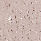 Immunohistochemical staining of human Cerebral cortex shows moderate granular cytoplasmic positivity in neuronal cells.