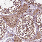 Immunohistochemical staining of human Testis shows moderate granular cytoplasmic positivity in Leydig cells and cells in seminiferous ducts.