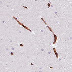 Immunohistochemical staining of human cerebellum shows immunoreactivity in the endothelial cells.