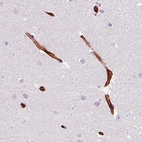 Immunohistochemical staining of human cerebellum shows immunoreactivity in the endothelial cells.