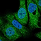 Immunofluorescent staining of human cell line HaCaT shows localization to nucleoplasm & cytosol.