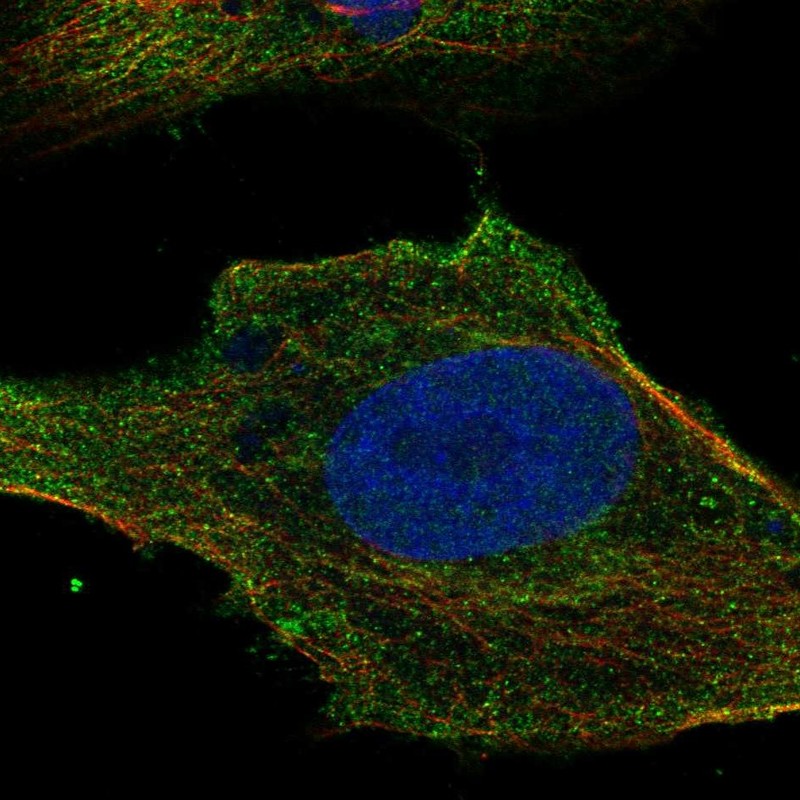 Anti-SLC6A7 Antibody