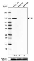 Anti-VCL Antibody