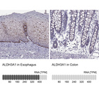 Anti-ALDH3A1 Antibody