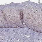 Immunohistochemical staining of human esophagus shows high expression.
