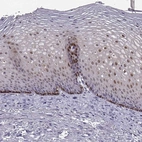 Immunohistochemical staining of human esophagus shows high expression.