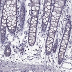 Immunohistochemical staining of human colon shows low expression as expected.
