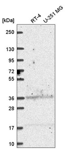 Western blot analysis in human cell line RT-4 and human cell line U-251 MG.