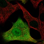 Immunofluorescent staining of human cell line A549 shows localization to nucleoplasm, cytosol & vesicles.