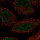 Anti-MEOX1 Antibody