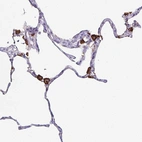 Immunohistochemical staining of human lung shows strong positivity in macrophages.