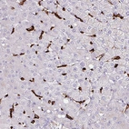 Immunohistochemical staining of human liver shows strong positivity in Kupffer cells.