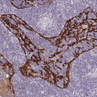 Immunohistochemical staining of human lymph node shows moderate membranous positivity.