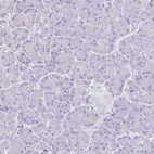 Immunohistochemical staining of human pancreas shows no positivity as expected.