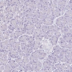 Immunohistochemical staining of human pancreas shows no positivity as expected.