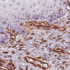 Immunohistochemical staining of human skin shows distinct positivity in fibroblasts.
