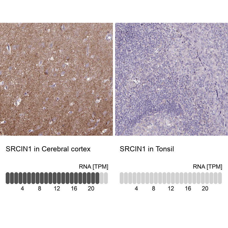 Anti-SRCIN1 Antibody