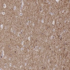 Immunohistochemical staining of human cerebral cortex shows strong positivity in neuronal processes in neuropil.