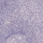Anti-SRCIN1 Antibody