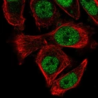 Immunofluorescent staining of human cell line PC-3 shows localization to nucleoplasm.