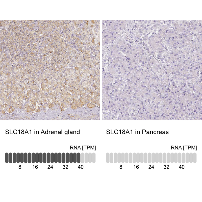 Anti-SLC18A1 Antibody