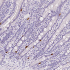 Immunohistochemical staining of human small intestine shows strong cytoplasmic positivity in neuroendocrine cells.
