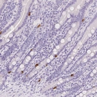 Immunohistochemical staining of human small intestine shows strong cytoplasmic positivity in neuroendocrine cells.