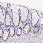 Immunohistochemical staining of human rectum shows strong cytoplasmic positivity in neuroendocrine cells.
