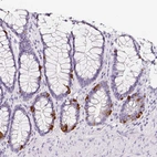 Immunohistochemical staining of human rectum shows strong cytoplasmic positivity in neuroendocrine cells.