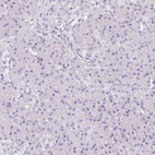 Immunohistochemical staining of human pancreas shows no positivity in exocrine glandular cells as expected.