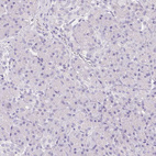 Anti-SLC18A1 Antibody
