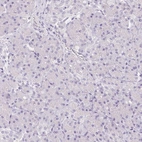 Immunohistochemical staining of human pancreas shows no positivity in exocrine glandular cells as expected.