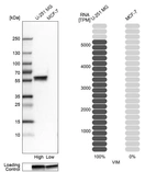 Western blot analysis in human cell lines U-251MG and MCF-7 using Anti-VIM antibody. Corresponding VIM RNA-seq data are presented for the same cell lines. Loading control: Anti-GAPDH.