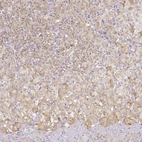 Immunohistochemical staining of human adrenal gland shows moderate cytoplasmic positivity in medullary cells.