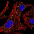 Anti-ARSD Antibody