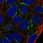 Immunofluorescent staining of human cell line RT4 shows localization to plasma membrane, the Golgi apparatus & cell junctions.