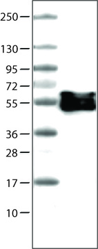 Anti-VIM Antibody