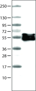 Lane 1: Marker [kDa] _br/_ Lane 2: Human tonsil tissue lysate