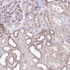 Immunohistochemical staining of human kidney shows weak to moderate cytoplasmic positivity in cells in tubules.
