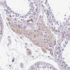 Immunohistochemical staining of human testis shows weak cytoplasmic positivity in Leydig cells.