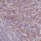 Anti-IFNGR1 Antibody