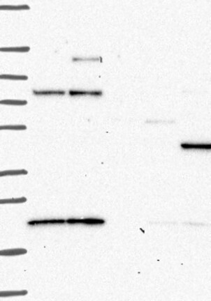 Anti-PRKAR2B Antibody
