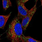 Immunofluorescent staining of human cell line SH-SY5Y shows localization to mitochondria.