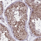 Immunohistochemical staining of human testis shows moderate to strong granular cytoplasmic positivity in cells in seminiferous ducts.