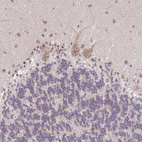 Anti-GOLGA5 Antibody