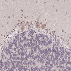 Immunohistochemical staining of human cerebellum shows moderate granular cytoplasmic positivity in Purkinje cells.