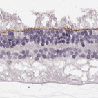 Immunohistochemical staining of human eye, retina using Anti-MPP5 antibody HPA063890.