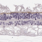 Immunohistochemical staining of human eye, retina using Anti-MPP5 antibody HPA063890.